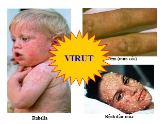 Bài giảng môn Sinh học Lớp 10 - Bài 29: Cấu trúc các loại virut (Bản hay)