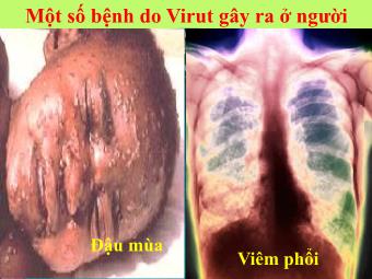 Bài giảng Sinh học Lớp 10 - Tiết 31, Bài 31: Virut gây bệnh. Ứng dụng của virut trong thực tiễn
