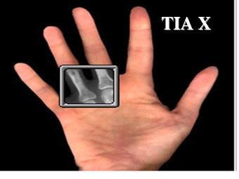 Bài giảng Vật lí Lớp 12 - Bài 28: Tia X (Bản hay)